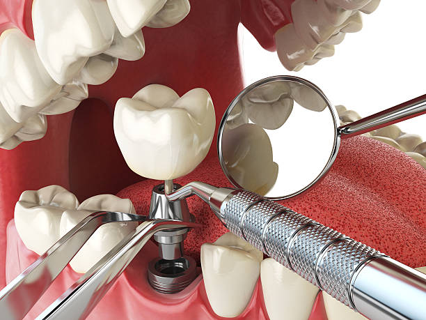 Fast & Reliable Emergency Dental Services in OH